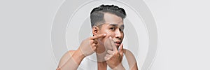 Handsome man touching his face. Squeezing pimple