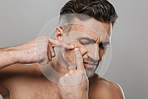 Handsome mature man naked take care of his skin squeezes out a pimple.