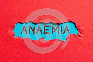 Handwriting text Anaemia. Concept meaning the practice of prescription drug preparation and dispensing Businessman In