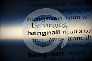 Hangnail