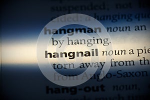 Hangnail photo