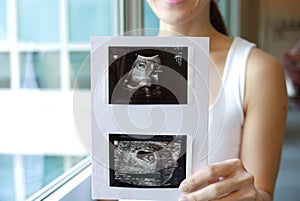 Happy Asian Chinese Woman smiling sweetly from pregnancy news