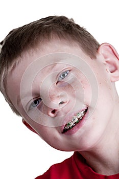 Happy Boy with braces