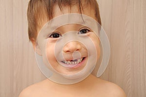 Happy boy with missing front teeth