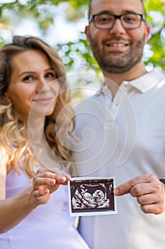 Happy couple with baby scan