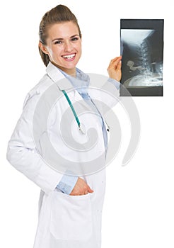 Happy doctor woman with fluorography photo