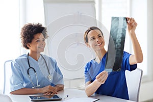 Happy female doctors with x-ray image at hospital