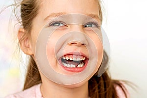 A happy girl  t-shirt without a front tooth laughs. Isolated on a white background.