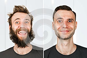 Happy guy with beard and without hair loss. Man before and after shave or transplant. haircut set transformation