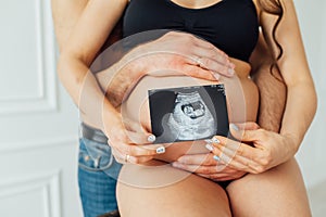 A happy married couple is holding in their hands a snapshot of an ultrasonic study of the baby.