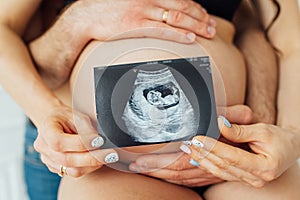 A happy married couple is holding in their hands a snapshot of an ultrasonic study of the baby.