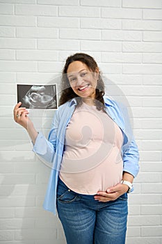 Happy positive adult pregnant woman, caressing her belly, smiling, showing at camera the ultrasound of her baby in womb