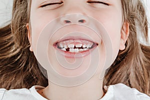 Happy smiling child portrait. Dental care, oral health. Close-up of teeth. Little todler attractive lovely sweet curious cheerful