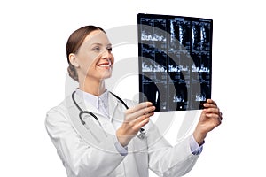 Happy smiling female doctor with x-ray