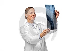 happy smiling female doctor with x-ray of spine
