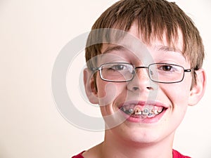 Happy teen boy with braces smiling