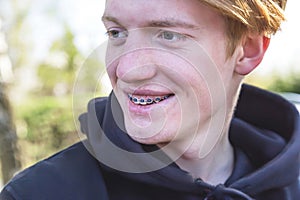 Happy teenager teen boy with dental braces. Funny expression.