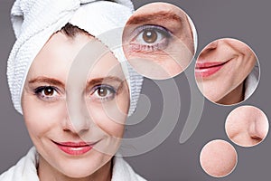 Happy woman after beauty treatment - before/after shots - skin c