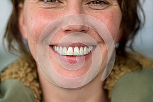 Happy woman giving a beaming toothy smile