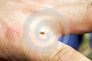 Hard mite, scale tick of family Ixodidae on human hand. Carrier of pathogens that can cause human disease