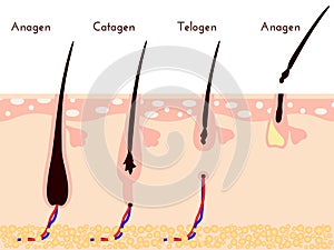 Hare care loos. life cycle of hair fall. vector illustration. photo