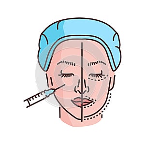 Harmonization of the profile with a filler color line illustration. Hyaluronic injection.