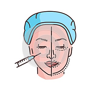 Harmonization of the profile with a filler color line illustration. Hyaluronic injection. photo