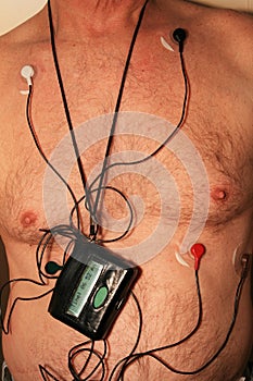 Harness cardiac monitor photo