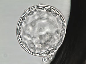 Hatched human blastocyst. Grade AA. on the fifth day of development. Viewed under the microscope