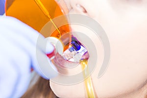 Having tooth treated