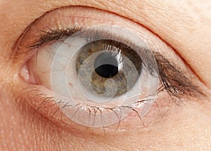 Hazel Eye photo