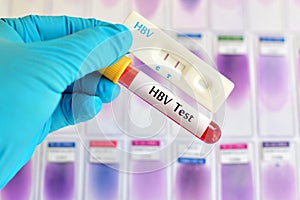 HBV test