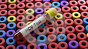 HCV virus test