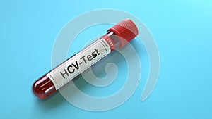 HCV virus test