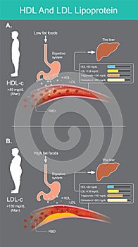 HDL And LDL Lipoprotein. Assessment of lipid levels in the blood from a laboratory blood test.