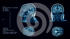Head and brain computer tomography result visualization. Four partitions slides of human head screening. 3D medical radiology