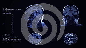 Head and brain computer tomography result visualization. Four partitions slides of human head screening. 3D medical radiology exam