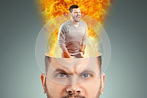 In the head of a disgruntled man, the brain is enraged and a fire burns. The concept of anger, hatred, contempt, stress, burnout,