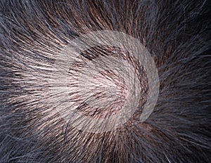 Head of glabrous baldness, Hair skin condition close up on monitor