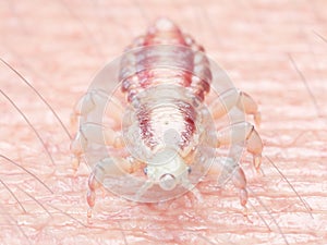 a head louse