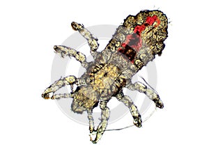 Head Louse - Pediculus capitis, microscope picture