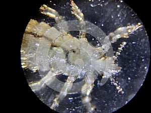 The head louse (Pediculus humanus capitis)