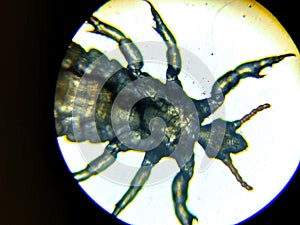 The head louse (Pediculus humanus capitis)