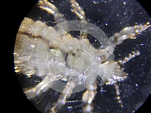 The head louse (Pediculus humanus capitis)