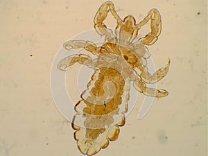 Head louse Pediculus humanus capitis under microscope