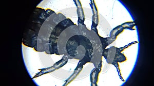 Head louse Under Microscope