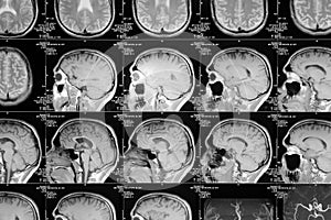 Head magnetic resonance image