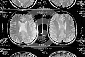 Head magnetic resonance image