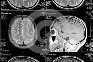 Head magnetic resonance image