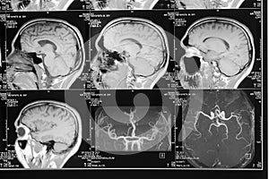 Head magnetic resonance image